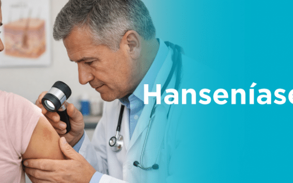 Veja como cuidar da sua saúde   prevenir a hanseníase
